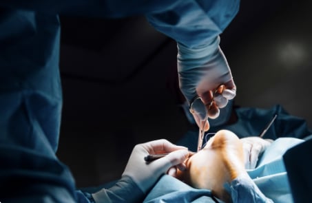 Neuromul Morton - diagnostic și tratament chirurgical
