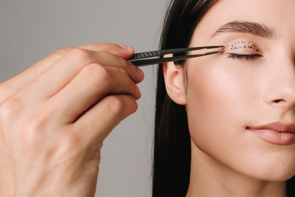 blefaroplastie